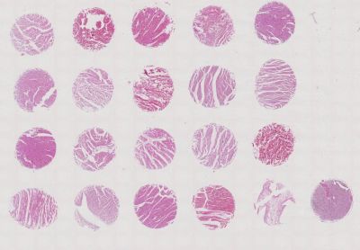 中科光华正常心肌组织芯片